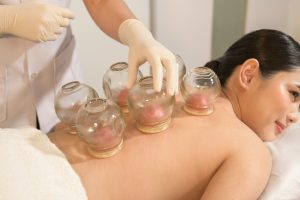 Cupping therapy evidence and techniques