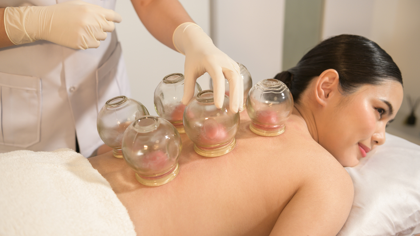 Cupping Therapy: Do Your Patients Really Need It? - BTE